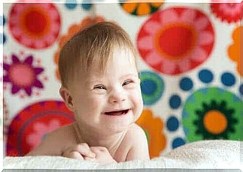 laughing baby with Down syndrome
