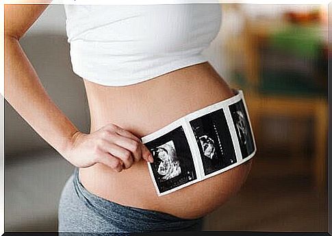 pregnant woman holding printout from sonography in front of belly
